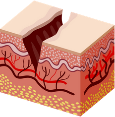 شكل الشرخ بالصور