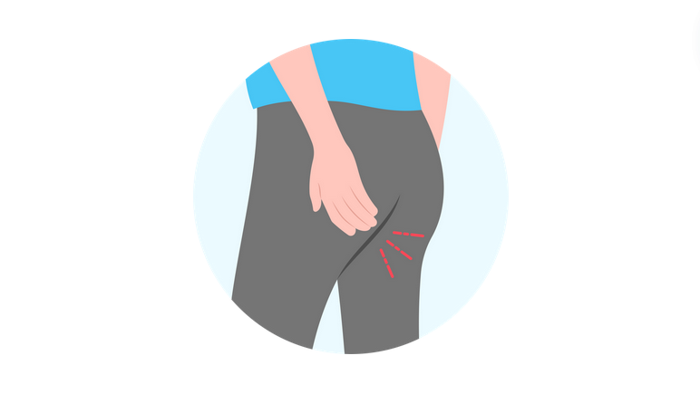 امراض الشرج